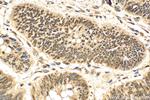 CRM1 Antibody in Immunohistochemistry (Paraffin) (IHC (P))