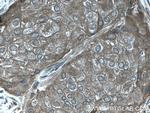 C19orf62 Antibody in Immunohistochemistry (Paraffin) (IHC (P))