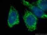 NDUFB4 Antibody in Immunocytochemistry (ICC/IF)