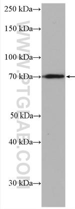 SLC10A6 Antibody in Western Blot (WB)