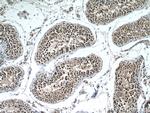 PAK6 Antibody in Immunohistochemistry (Paraffin) (IHC (P))