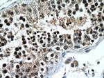 PAK6 Antibody in Immunohistochemistry (Paraffin) (IHC (P))