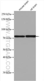 PAK6 Antibody in Western Blot (WB)