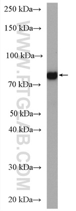 PAK6 Antibody in Western Blot (WB)