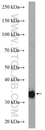 GPD1 Antibody in Western Blot (WB)