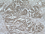 AKAP13 Antibody in Immunohistochemistry (Paraffin) (IHC (P))