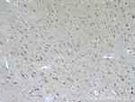 GBA Antibody in Immunohistochemistry (Paraffin) (IHC (P))