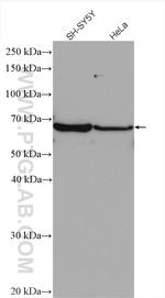 GBA Antibody in Western Blot (WB)