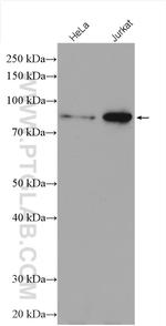 ZBTB24 Antibody in Western Blot (WB)