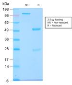 GnRH-Receptor/LH-RH Receptor Antibody in SDS-PAGE (SDS-PAGE)