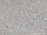 ANK3 Antibody in Immunohistochemistry (Paraffin) (IHC (P))