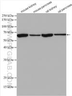 KLKB1 Antibody in Western Blot (WB)