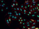 BPTF Antibody in Immunocytochemistry (ICC/IF)