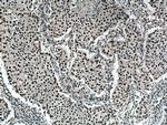 BPTF Antibody in Immunohistochemistry (Paraffin) (IHC (P))