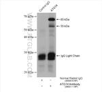 ATG14 Antibody in Immunoprecipitation (IP)