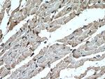 FADS2 Antibody in Immunohistochemistry (Paraffin) (IHC (P))