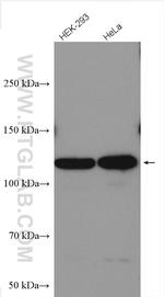 SMG8 Antibody in Western Blot (WB)