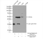 RAD52 Antibody in Immunoprecipitation (IP)