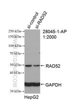 RAD52 Antibody in Western Blot (WB)