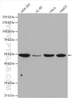 RAD52 Antibody in Western Blot (WB)