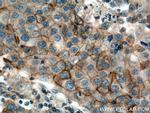 SLC12A2 Antibody in Immunohistochemistry (Paraffin) (IHC (P))