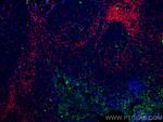 PD-L1/CD274 Antibody in Immunohistochemistry (Paraffin) (IHC (P))