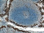 PD-L1/CD274 Antibody in Immunohistochemistry (Paraffin) (IHC (P))