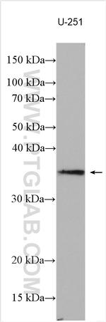 SEC22C Antibody in Western Blot (WB)