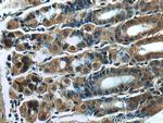 RSAD2 Antibody in Immunohistochemistry (Paraffin) (IHC (P))