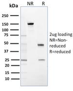 14-3-3 Sigma/Stratifin Antibody in SDS-PAGE (SDS-PAGE)