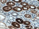 KL Antibody in Immunohistochemistry (Paraffin) (IHC (P))