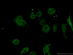 LIMD1 Antibody in Immunocytochemistry (ICC/IF)