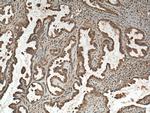 CDC25B Antibody in Immunohistochemistry (Paraffin) (IHC (P))