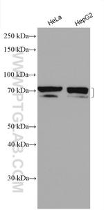 CDC25B Antibody in Western Blot (WB)