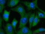 AKT2 Antibody in Immunocytochemistry (ICC/IF)