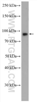 Endoglin/CD105 Antibody in Western Blot (WB)