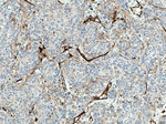 Endoglin/CD105 Antibody in Immunohistochemistry (Paraffin) (IHC (P))