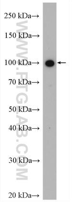 SLC4A1 Antibody in Western Blot (WB)