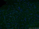 NET1 Antibody in Immunohistochemistry (Paraffin) (IHC (P))