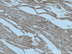 ASK1 Antibody in Immunohistochemistry (Paraffin) (IHC (P))