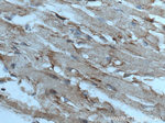 ASK1 Antibody in Immunohistochemistry (Paraffin) (IHC (P))