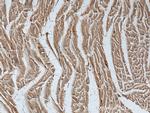 ASK1 Antibody in Immunohistochemistry (Paraffin) (IHC (P))