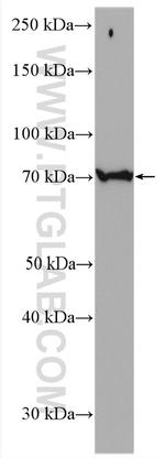 ASK1 Antibody in Western Blot (WB)