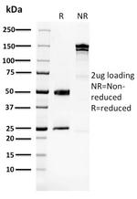 Glucose 6-Phosphate Isomerase Antibody in SDS-PAGE (SDS-PAGE)