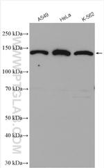 CTC1 Antibody in Western Blot (WB)