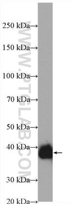 SFRP1 Antibody in Western Blot (WB)