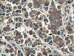 mTOR Antibody in Immunohistochemistry (Paraffin) (IHC (P))