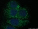 RAB17 Antibody in Immunocytochemistry (ICC/IF)