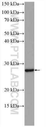 RAB17 Antibody in Western Blot (WB)