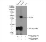 TSG101 Antibody in Immunoprecipitation (IP)